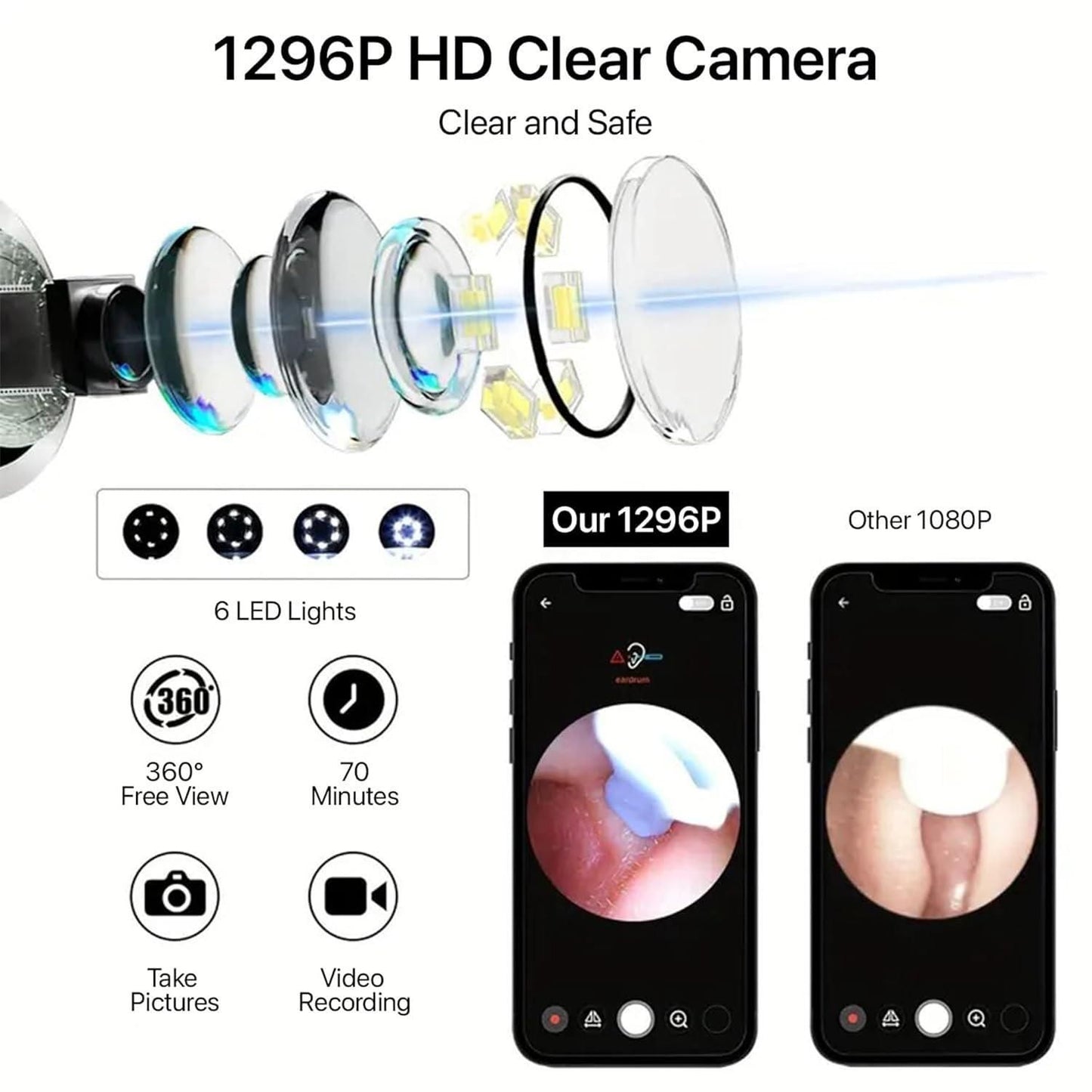 Smart Visual Ear Wax Cleaner with Camera, 1080p FHD Led Light, 360° Visual WIFI Camera